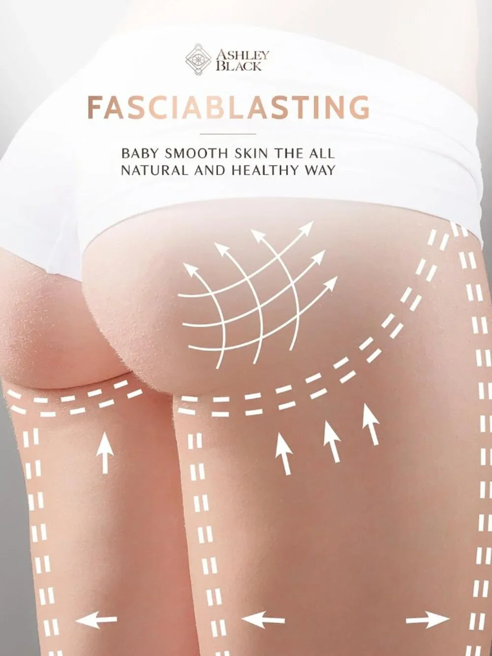 Ashley Black Original FasciaBlaster Cellulite MINI 2 Trigger Point Massage Tool